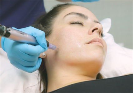 Collagen Stimulation Photo